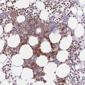 Anti-PPM1A antibody produced in rabbit 