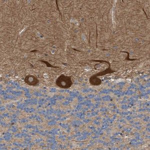 Anti-PPM1B antibody produced in rabbit HPA016745-100UL