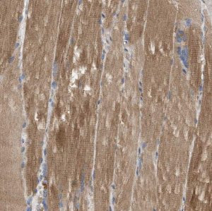 Anti-PPM1B antibody produced in rabbit HPA016745-100UL