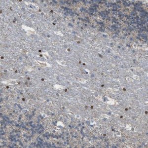 Anti-PPM1D antibody produced in rabbit 