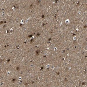 Anti-PPM1E antibody produced in rabbit 
