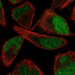 Anti-PPME1 antibody produced in rabbit 