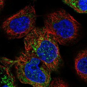 Anti-PPOX antibody produced in rabbit 