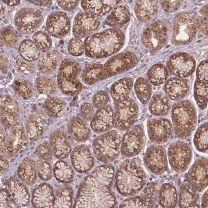 Anti-PPP1CB antibody produced in rabbit 