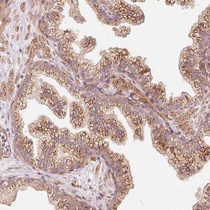 Anti-PPP1R14B antibody produced in rabbit 