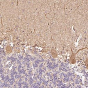 Anti-PPP1R1B antibody produced in rabbit HPA048630-100UL