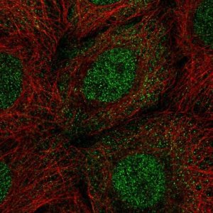 Anti-PPP1R2 antibody produced in rabbit 