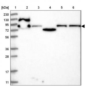 Anti-PPP1R21 antibody produced in rabbit 