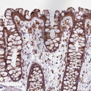 Anti-PPP1R27 antibody produced in rabbit 