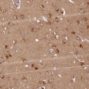 Anti-PPP1R37 antibody produced in rabbit 