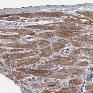 Anti-PPP1R3C antibody produced in rabbit 