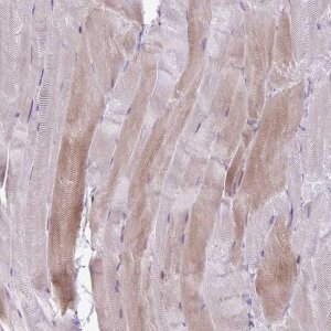 Anti-PPP1R3E antibody produced in rabbit 