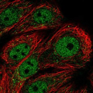 Anti-PPP1R3F antibody produced in rabbit 