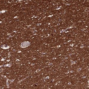 Anti-PPP2R2B antibody produced in rabbit 