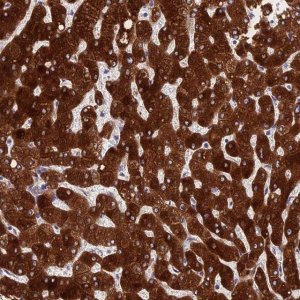 Anti-PPP2R2D antibody produced in rabbit 