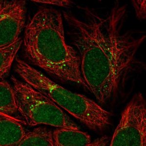 Anti-PPP2R3C antibody produced in rabbit 