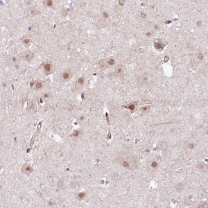 Anti-PPP2R5B antibody produced in rabbit 