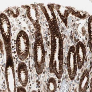 Anti-PPP2R5E antibody produced in rabbit 