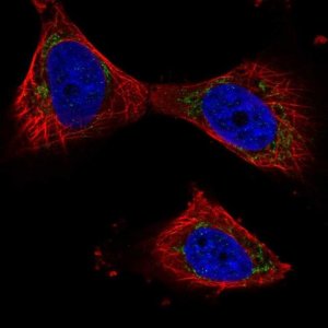 Anti-PPP3CB antibody produced in rabbit HPA008823-100UL