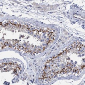 Anti-PPP3CC antibody produced in rabbit 