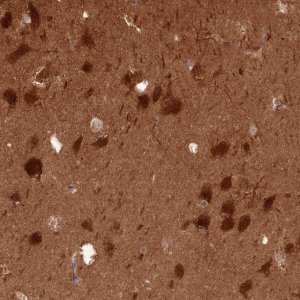 Anti-PPP3R1 antibody produced in rabbit 