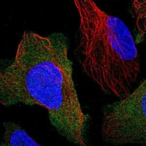 Anti-PPP3R1 antibody produced in rabbit 
