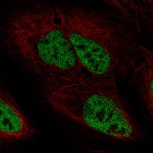 Anti-PPP4R2 antibody produced in rabbit 