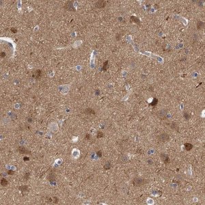 Anti-PPP5C antibody produced in rabbit HPA029065-100UL