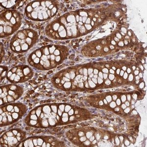 Anti-PPP6R3 antibody produced in rabbit 