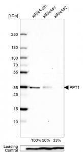 Anti-PPT1 antibody produced in rabbit 
