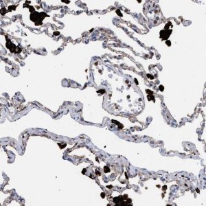 Anti-PPT1 antibody produced in rabbit 