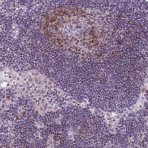 Anti-PQLC1 antibody produced in rabbit 