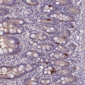 Anti-PRADC1 antibody produced in rabbit 