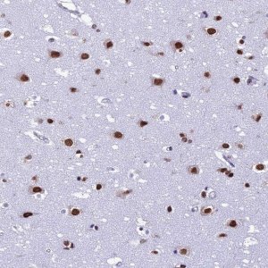 Anti-PRAMEF12 antibody produced in rabbit 