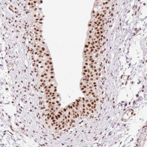 Anti-PRDM11 antibody produced in rabbit 