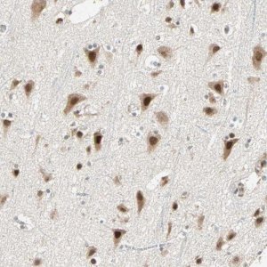 Anti-PRDM2 antibody produced in rabbit 