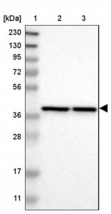 Anti-PREB antibody produced in rabbit 