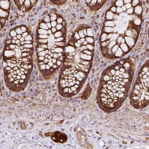 Anti-PRELID3B antibody produced in rabbit 