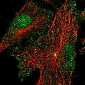 Anti-PRICKLE3 antibody produced in rabbit 