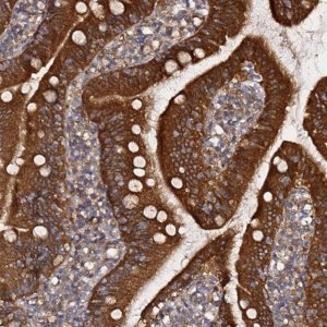 Anti-PRKAB2 antibody produced in rabbit 