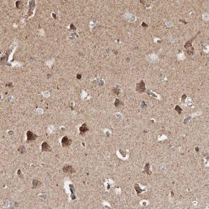 Anti-PRKACB antibody produced in rabbit 