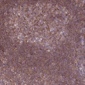 Anti-PRKAR1A antibody produced in rabbit 