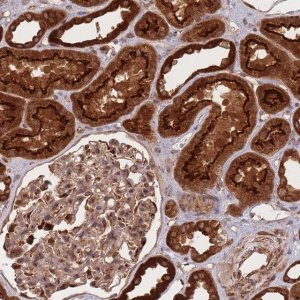 Anti-PRKAR2A antibody produced in rabbit 