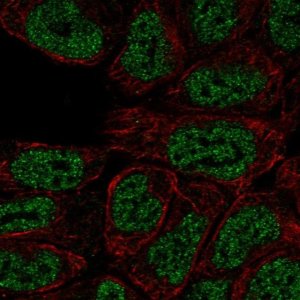 Anti-PRKCB antibody produced in rabbit 