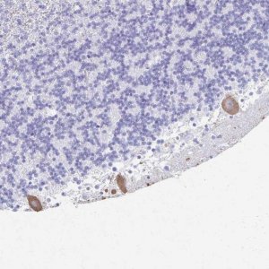 Anti-PRKCG antibody produced in rabbit 