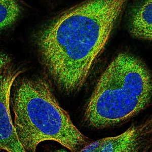 Anti-PRKCI antibody produced in rabbit 