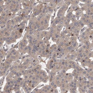 Anti-PRKD1 antibody produced in rabbit 