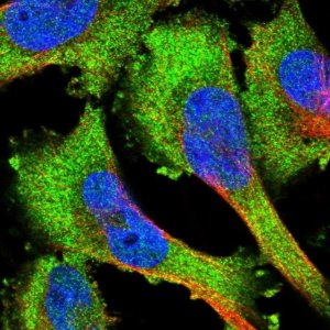 Anti-PRKD1 antibody produced in rabbit 
