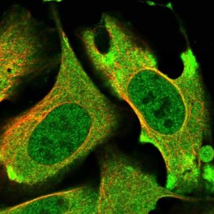 Anti-PRKD3 antibody produced in rabbit 