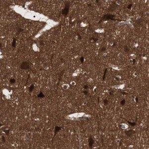 Anti-PRKG2 antibody produced in rabbit 